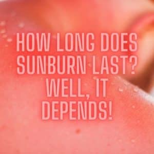 How Long Does Sunburn Last Well, it Depends!