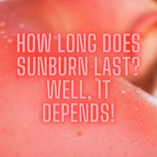 How Long Does Sunburn Last Well, it Depends!