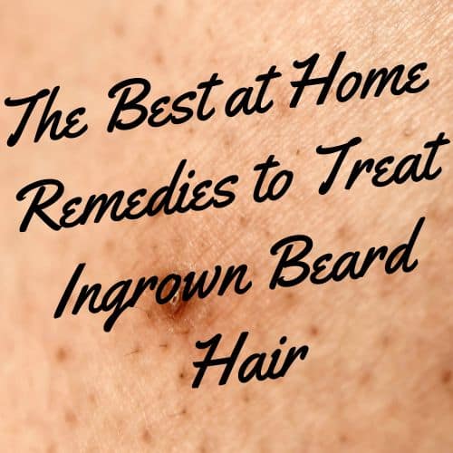 ingrown beard hair